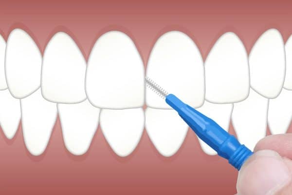 Odontograma - O Que é, Conceito E Definição